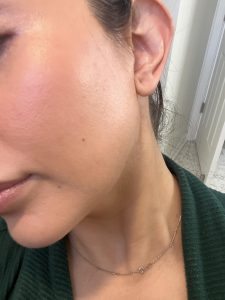 Customer photo