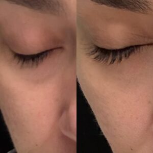 Customer photo