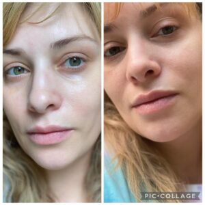 Customer photo